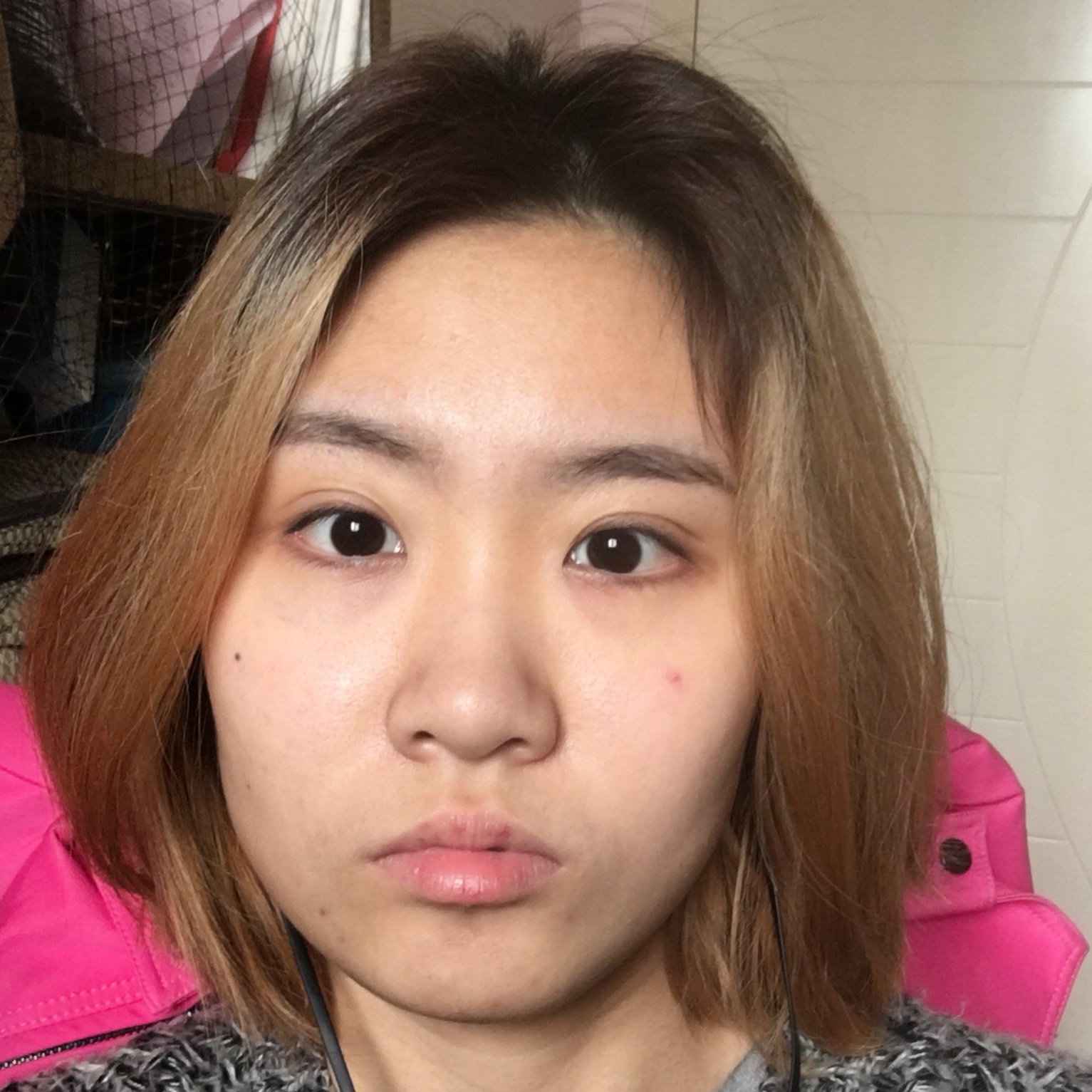 求问医生我这个为什么左右脸不对称 而_新氧美容整形