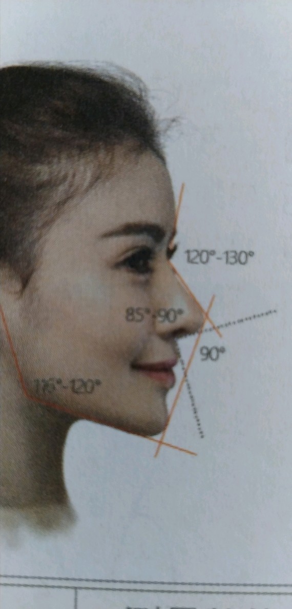 要考虑鼻子长度,坡度,130度鼻额角,90度鼻唇角,85度鼻尖角等多种因素