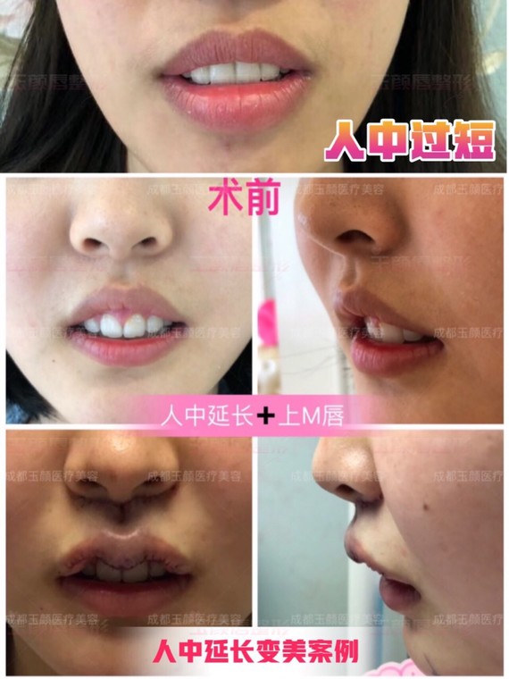 圈子-新氧美容整形