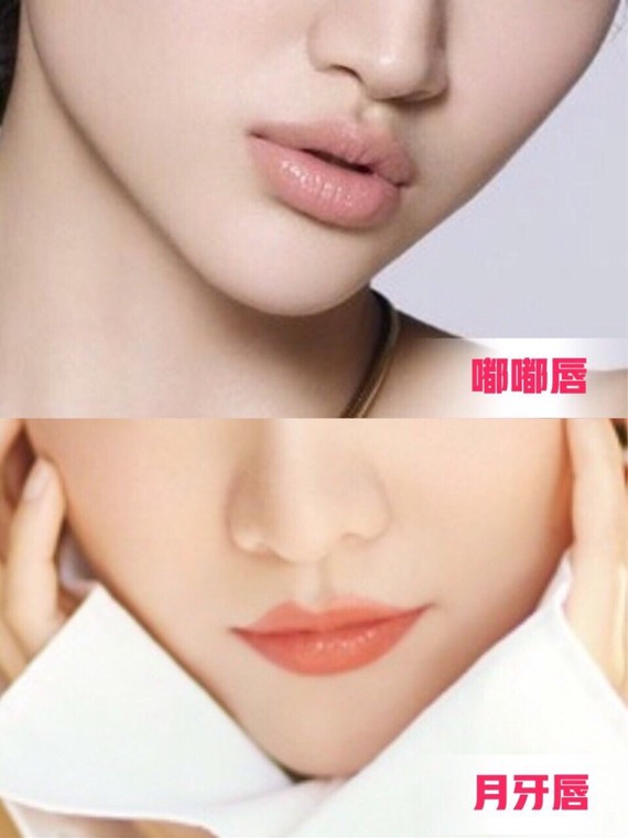 圈子-新氧美容整形