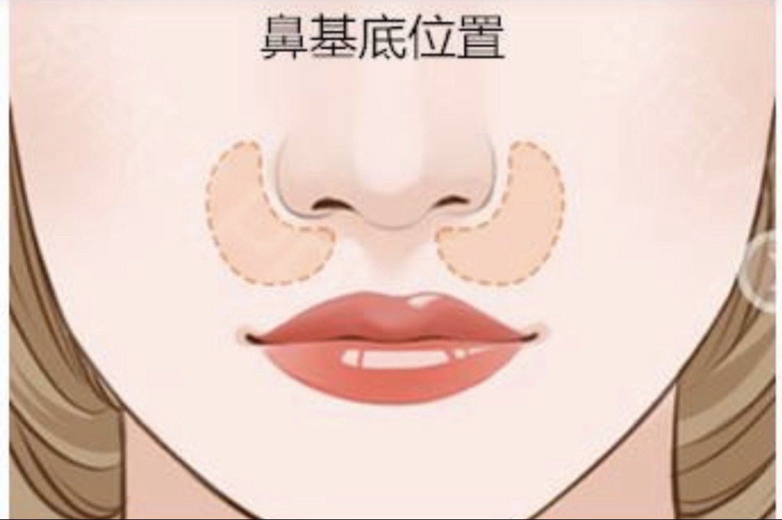 你好,鼻基底是鼻与上唇相连的基底部分,鼻基底的高度主要是指与鼻小柱
