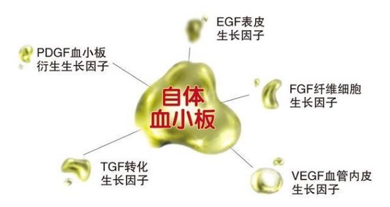 您好,PRP(PlateletRichPlasma)是指富含血小板