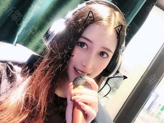 膨体材料的确容易感染,究其根源在于以下三点