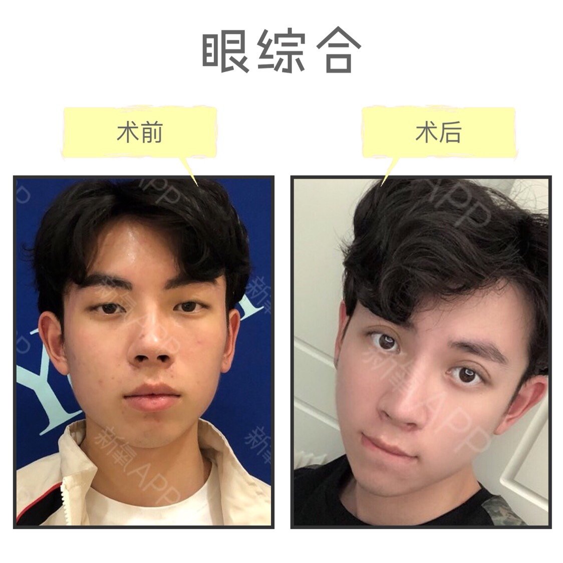 以下案例可做参考