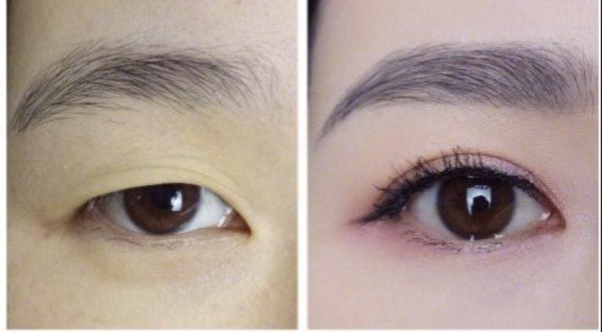 老师帮我看一下我的两个眼睛还有没有恢复到一样的可能我这是第一次