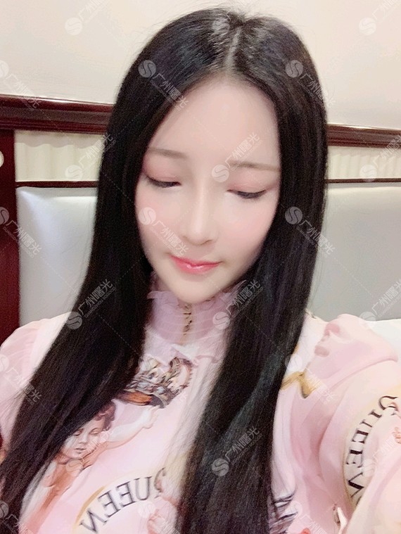 好,从照片上看,鼻梁高、鼻尖翘,鼻尖高出鼻背的