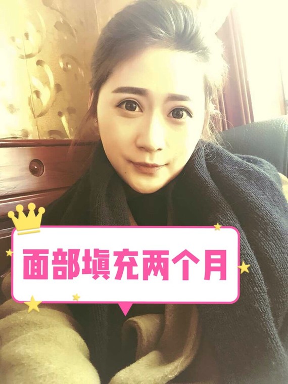 您好,首先,皮下组织的主要成分为脂肪细胞、纤