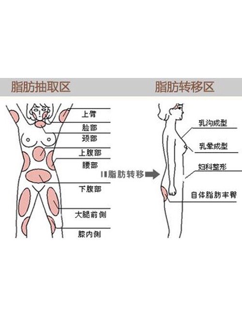 腹部左侧疼痛有硬块的原因 壹读