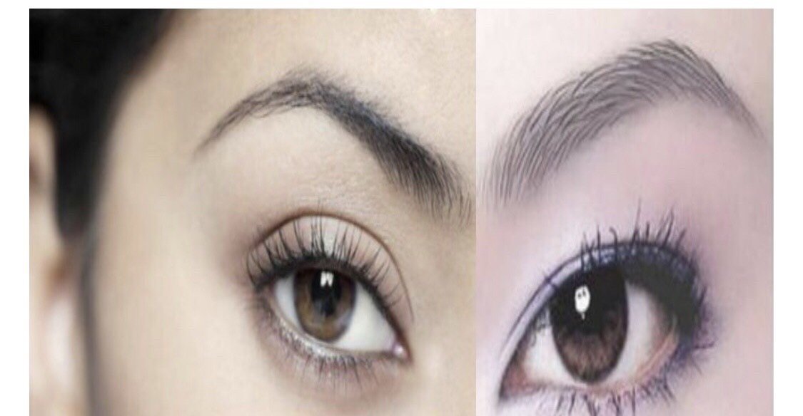 与眶上缘平行的弓形隆起,也是额部与眼眶的交界结构,往往与眉毛重叠