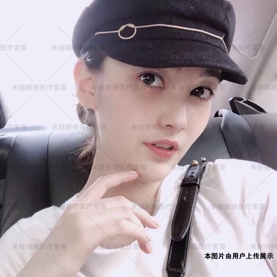 你好,以下是柳叶形假体和L型假体区别,参考一