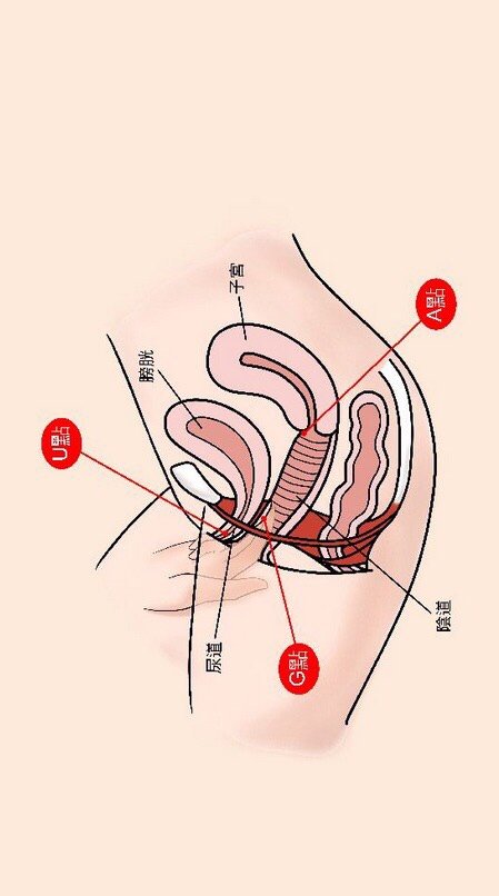 陰吹是什麼