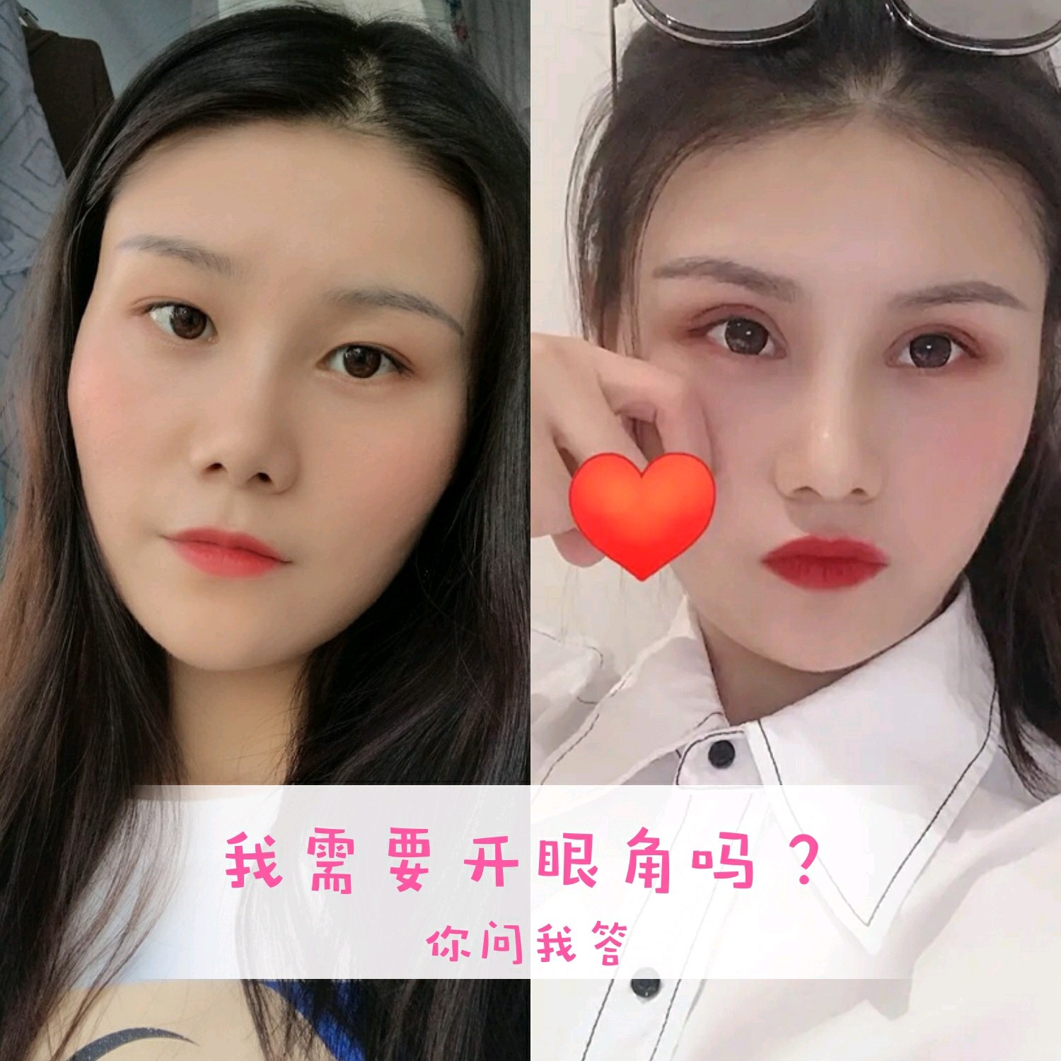 从照片上看你的内眼角偏圆,两眼间距较大,但是因为照片不清晰,艘栽