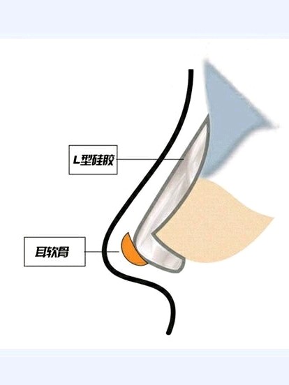 长度和形状的区别