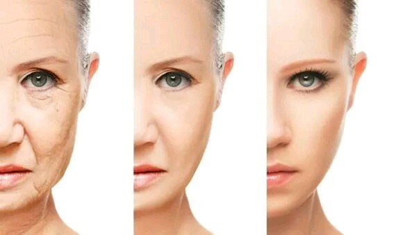 通过填充玻尿酸,将脸部凹陷的地方填充饱满,达到一个面部曲线更立体