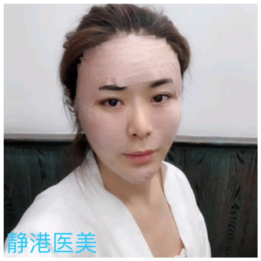 怎么办今天填充第12天了依旧肿的跟猴子 新氧美容整形