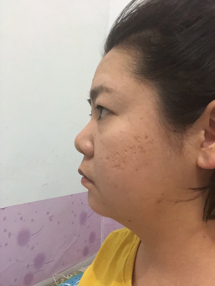 笑起来很丑,侧面像大饼脸