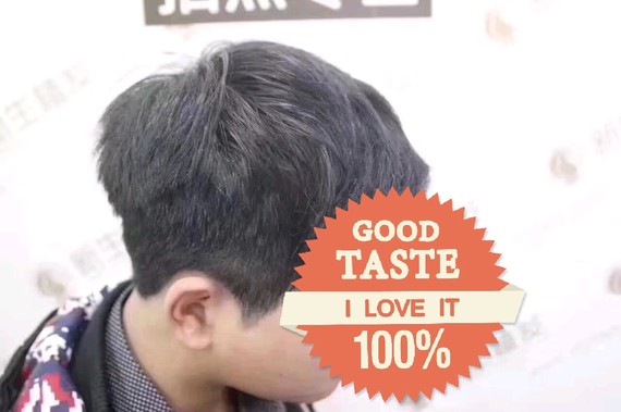 您好!可以的呢,头发种植是运用自体毛发移植的