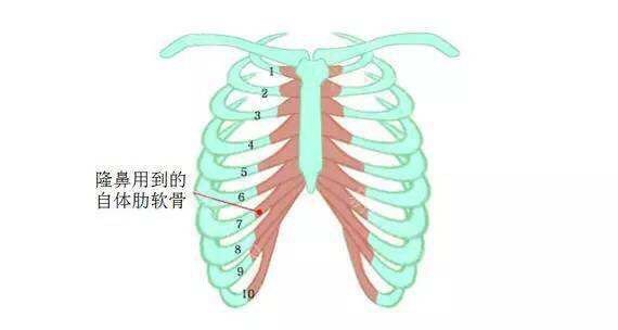 每个人都适合做肋软骨吗 新氧美容整形