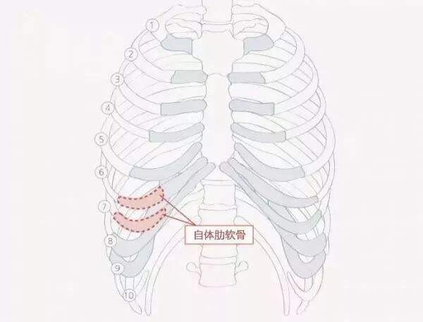 医生 做肋软骨隆鼻 取出来的肋软骨对 新氧美容整形