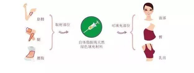 脂肪填充的存活率主要和什么有关呢 新氧美容整形