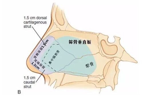 筛骨垂直板图片