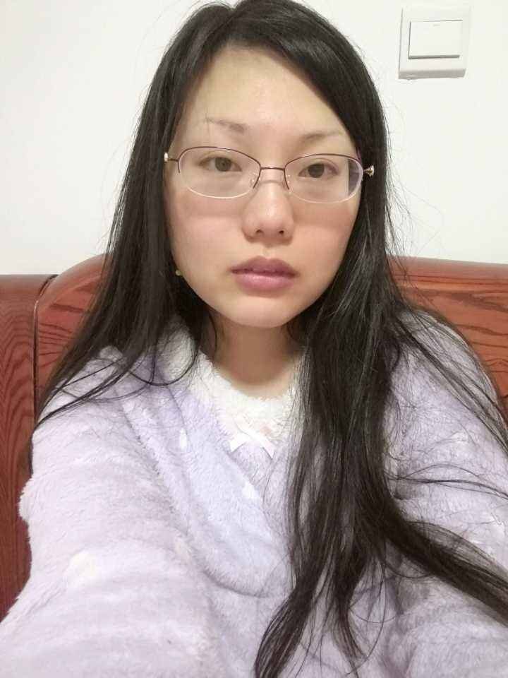 近视眼好多年眼睛也变形了想做近视手术和双眼皮手术不知道先做哪