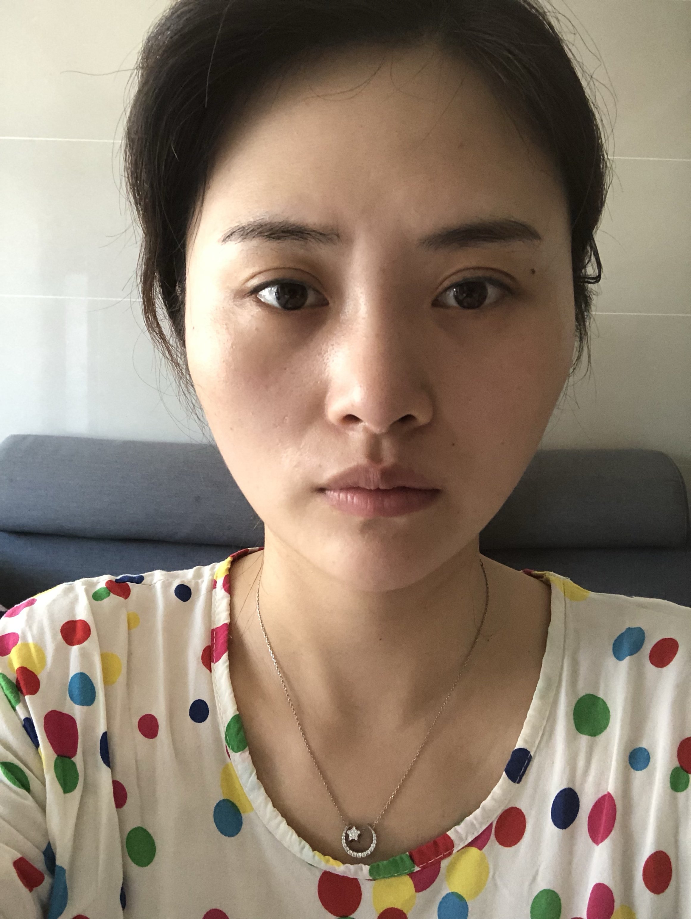 脸比较宽想让脸变小点秀气点但是又害怕磨骨有什么建议吗