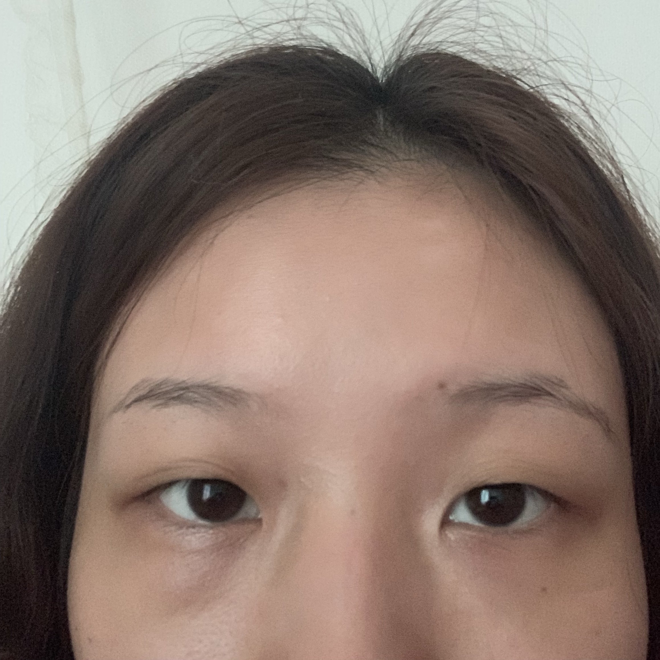 想知道自己的眼睛是不是上睑下垂是否做 新氧美容整形