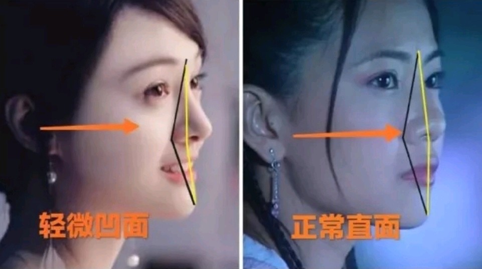 氧叔我瘦下来后脸凹了,鼻基底低,下颌角明显,如何把平淡颜值升级呢?