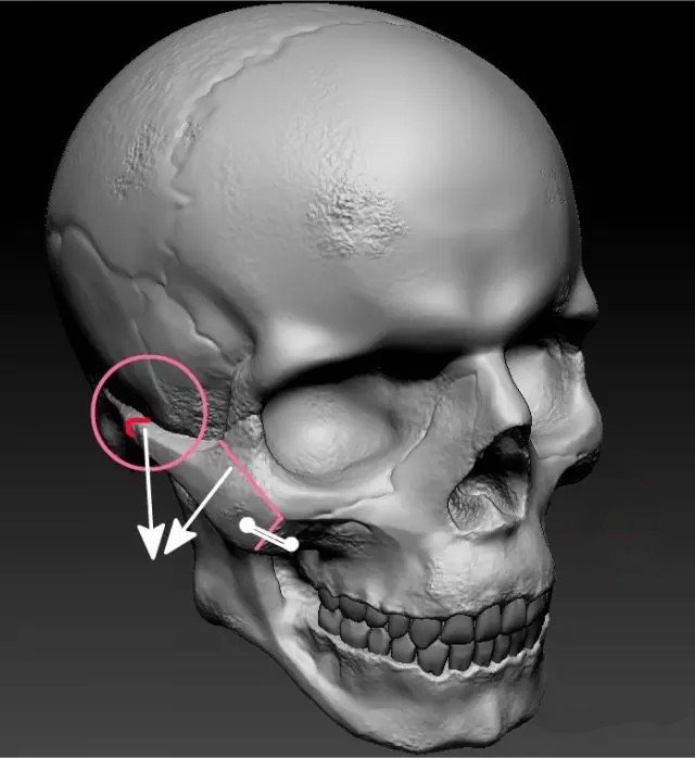 颧骨内推后遗症有什么呢