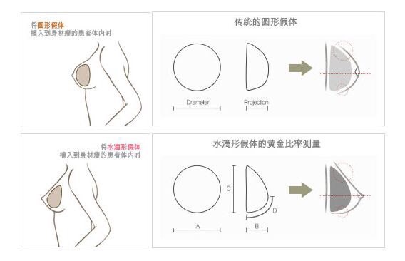 我想做假体隆胸,怎么选择假体?应该注意些什么呢?