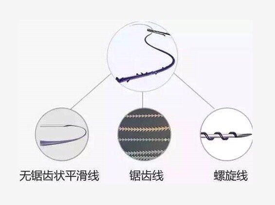 线雕线的根数和最后的效果有直接的关系吗是越多越好吗