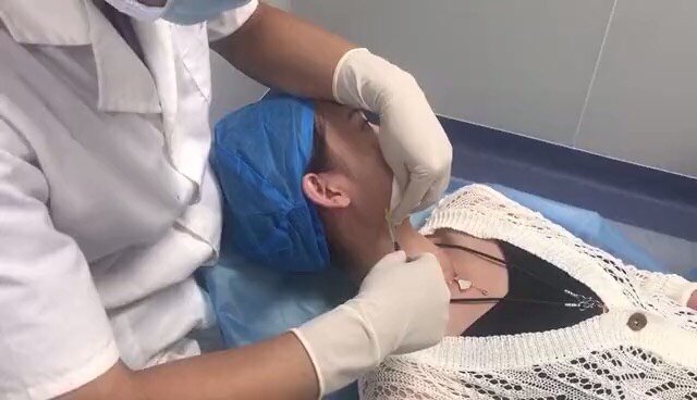 打瘦脸针了,感觉肌肉酸酸胀胀的,打得时候不怎么疼,_圈子-新氧美容