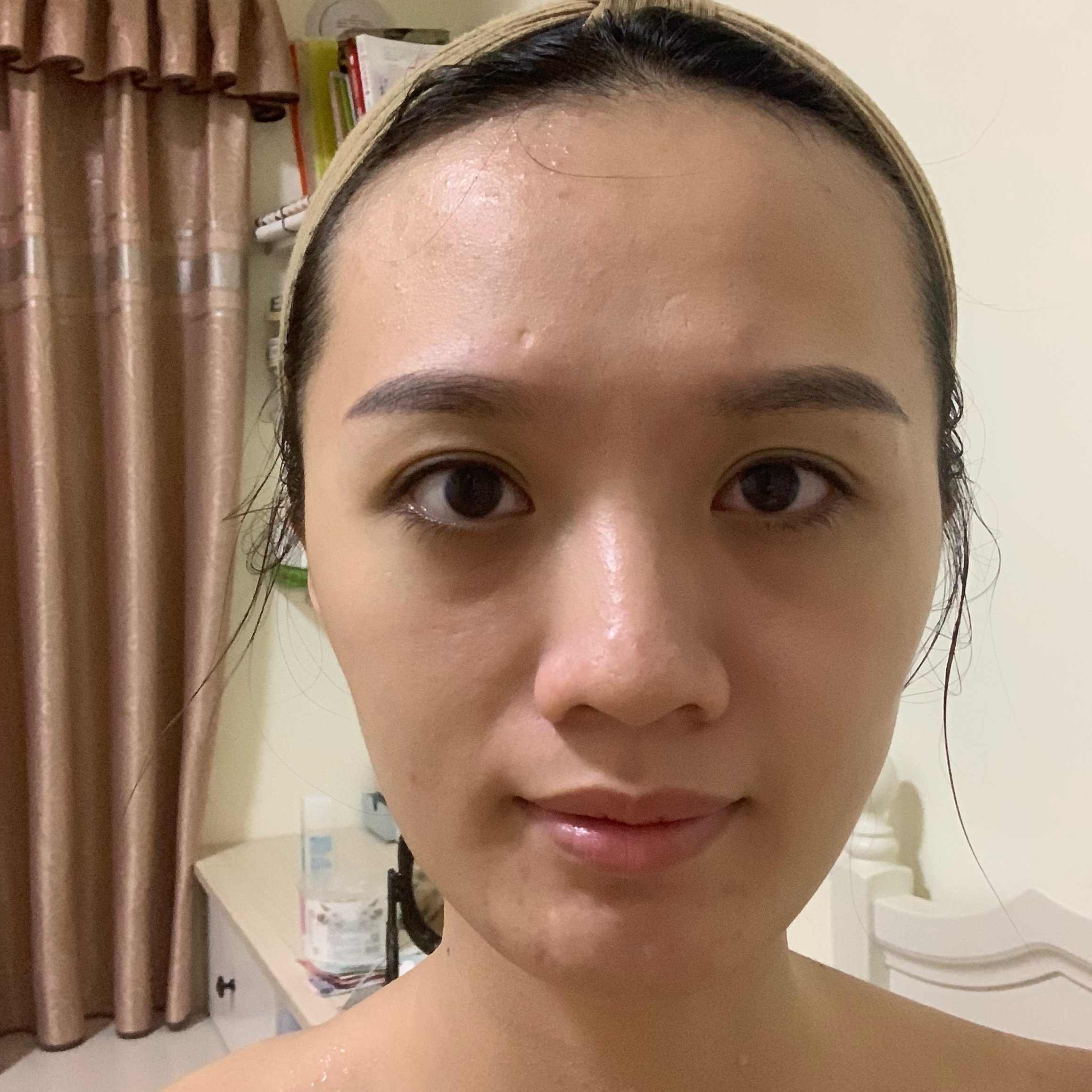 请问医生我脸部有啥bug 觉得自己颧骨外 新氧 专业医美服务平台