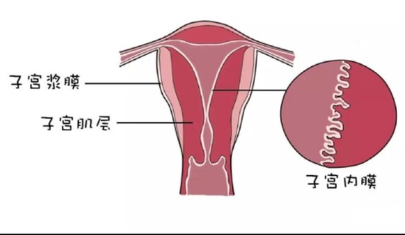 你好,子宫壁增厚的原因