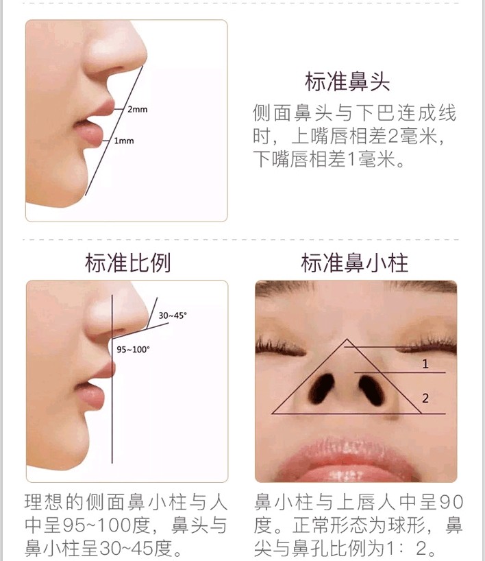 鼻部多项有哪些项目 新氧美容整形