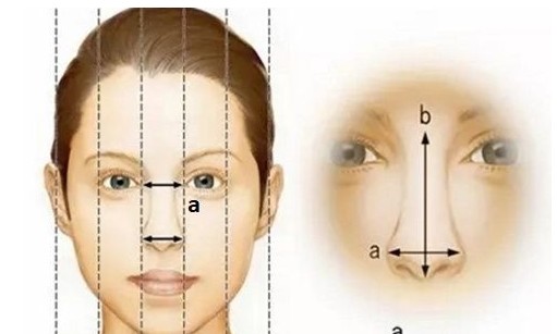 我有歪鼻这个能矫正到正吗 鼻翼缩小是 新氧美容整形