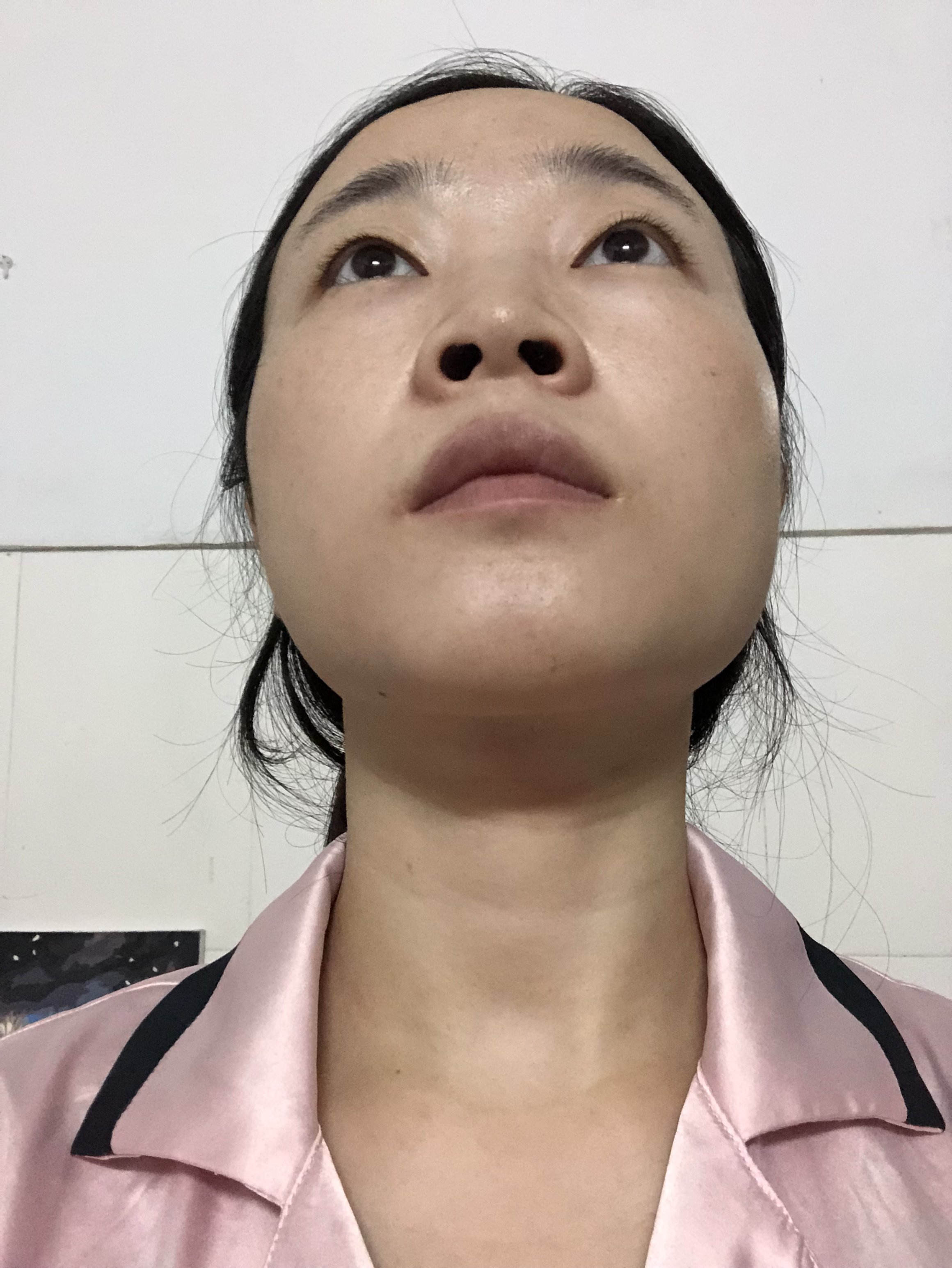 喜欢自然风格,我自己觉得自己有遮瞳和提肌无力问题,眼睛向上时就有双