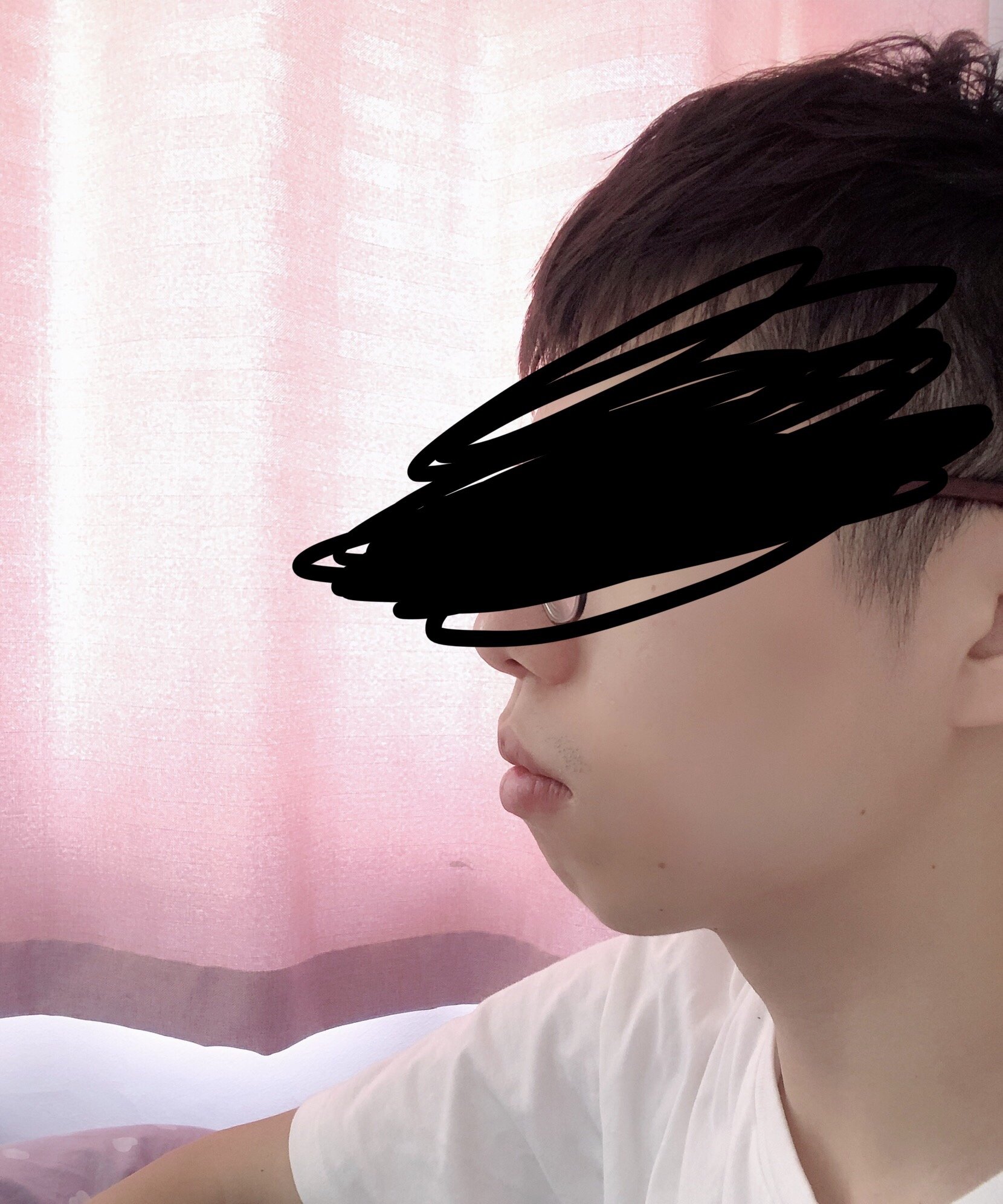 男生求助这是下巴后缩问题还是牙齿前凸问题怎么解决啊