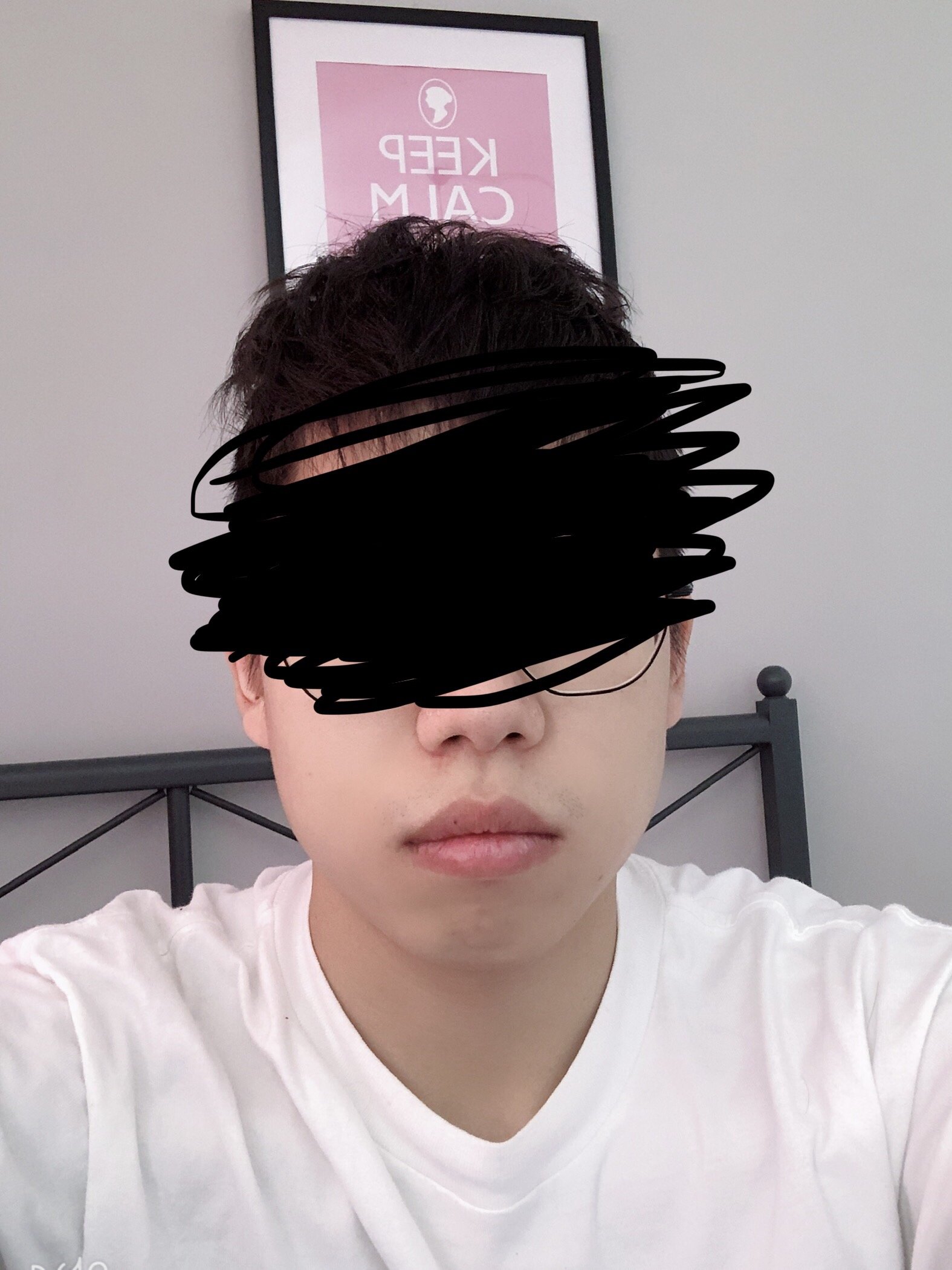 男生求助这是下巴后缩问题还是牙齿前凸问题怎么解决啊