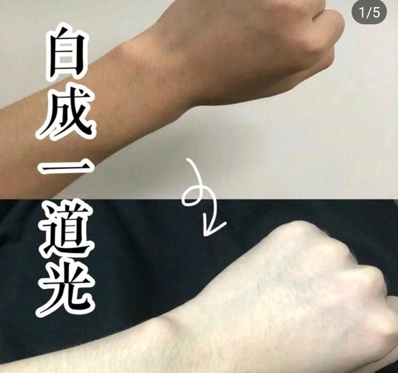 打美白注射可以淡斑吗 新氧美容整形