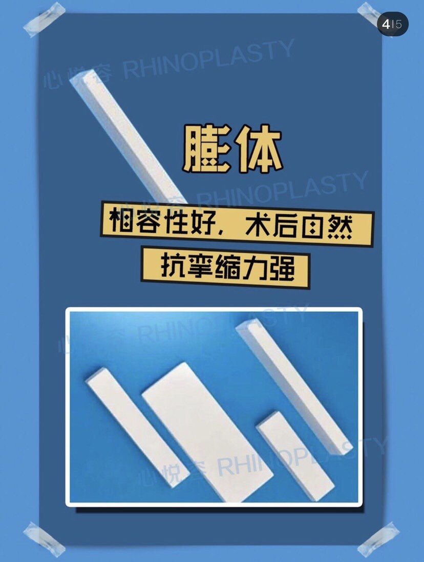 聽說超體隆鼻是目前最先進的鼻整形手法,想問一下,超體隆鼻適合咱們