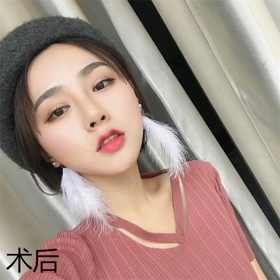 圈子-新氧美容整形