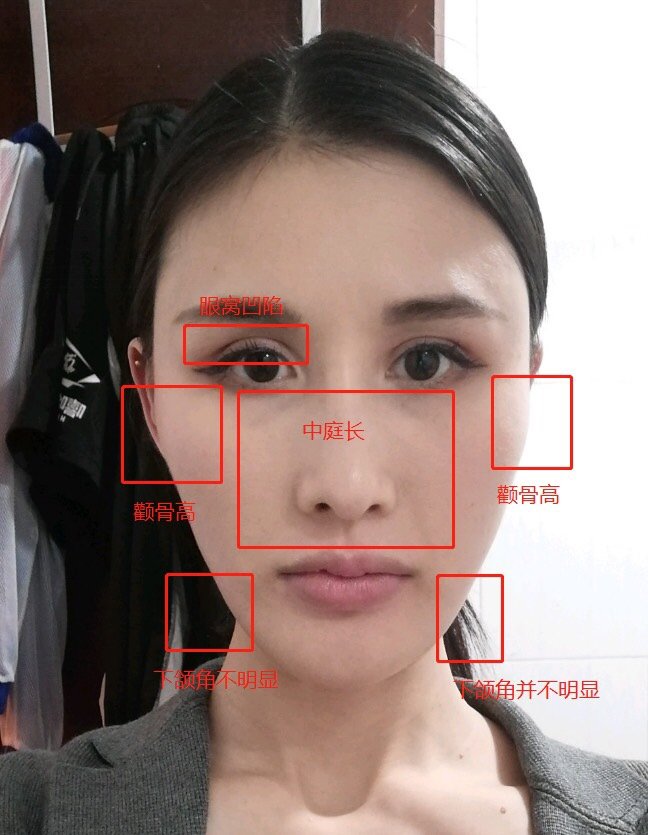 颧骨外扩→推颧骨→增加面部柔和感. 眼距近→化妆时不要提亮眼头.