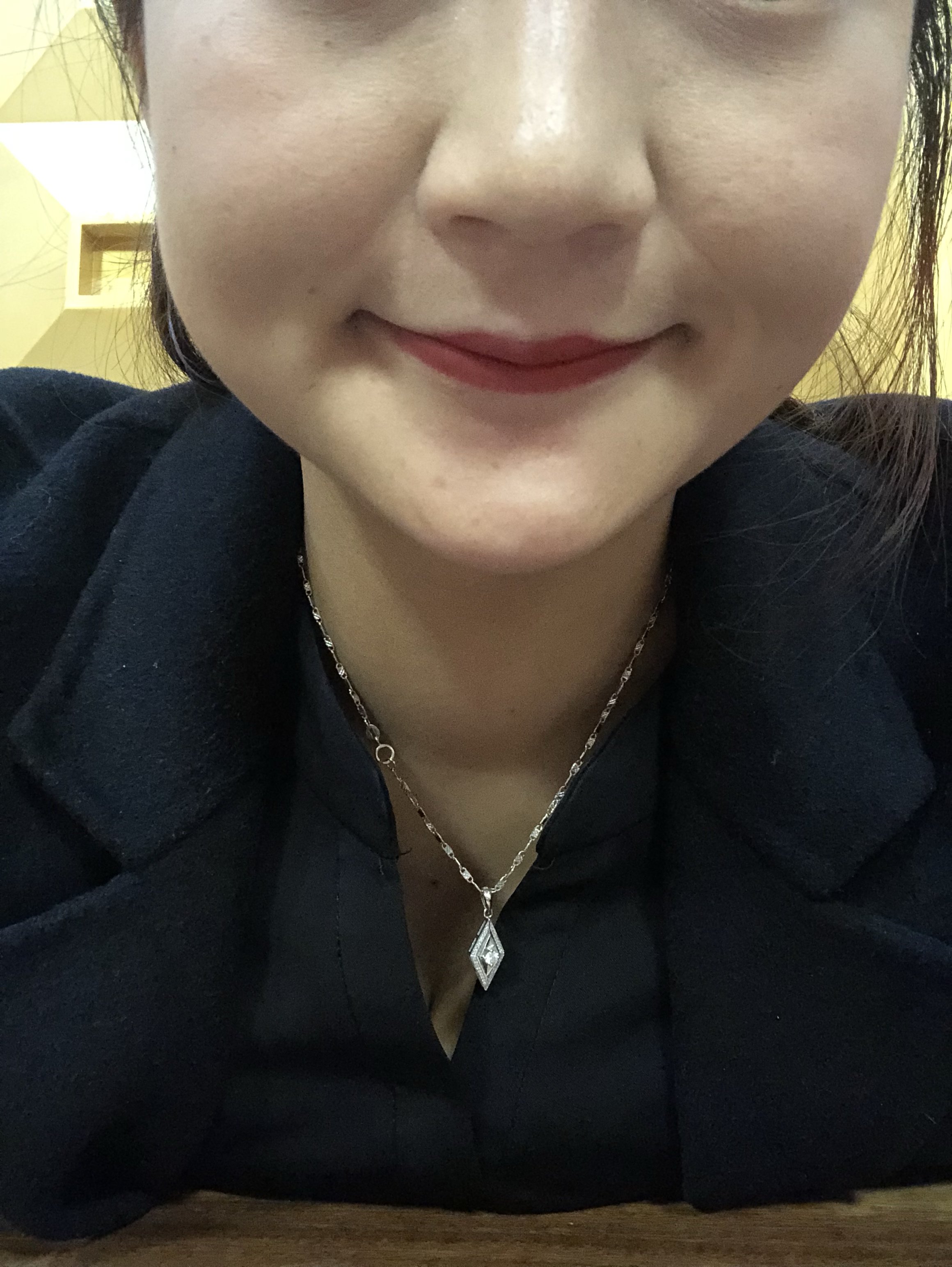 28岁法令纹深我需要填充法令纹还是鼻基底还是苹果肌