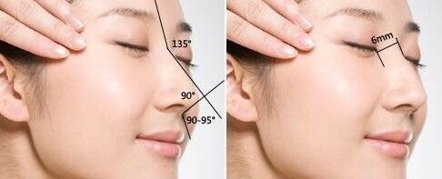 鼻额角:此角的大小和位置的高低对容貌甚为重要,一般120-130°为宜