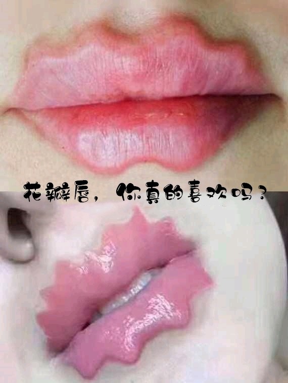 首页 此页面仅支持预览 Avatar 林春华 131篇日记 花瓣唇辣眼睛 唇部美学应该是这样打开的嘴唇形状形似花瓣 又称之为花瓣唇 听上去很美 但是不少人辣眼睛 这样的嘴唇真的好看吗 大众审美中真的接受不少了这样的嘴唇 嘴巴是五官中最性感的部位
