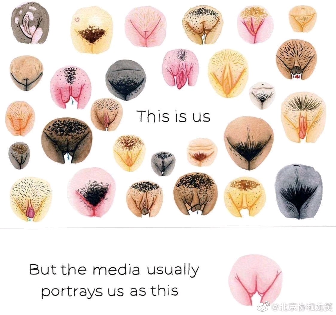 小阴唇为一对纵长的皮肤粘膜皱襞,位于两侧大阴唇之间.