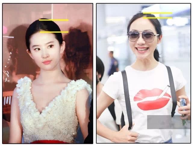 你可能不是脸大只是颅顶低!