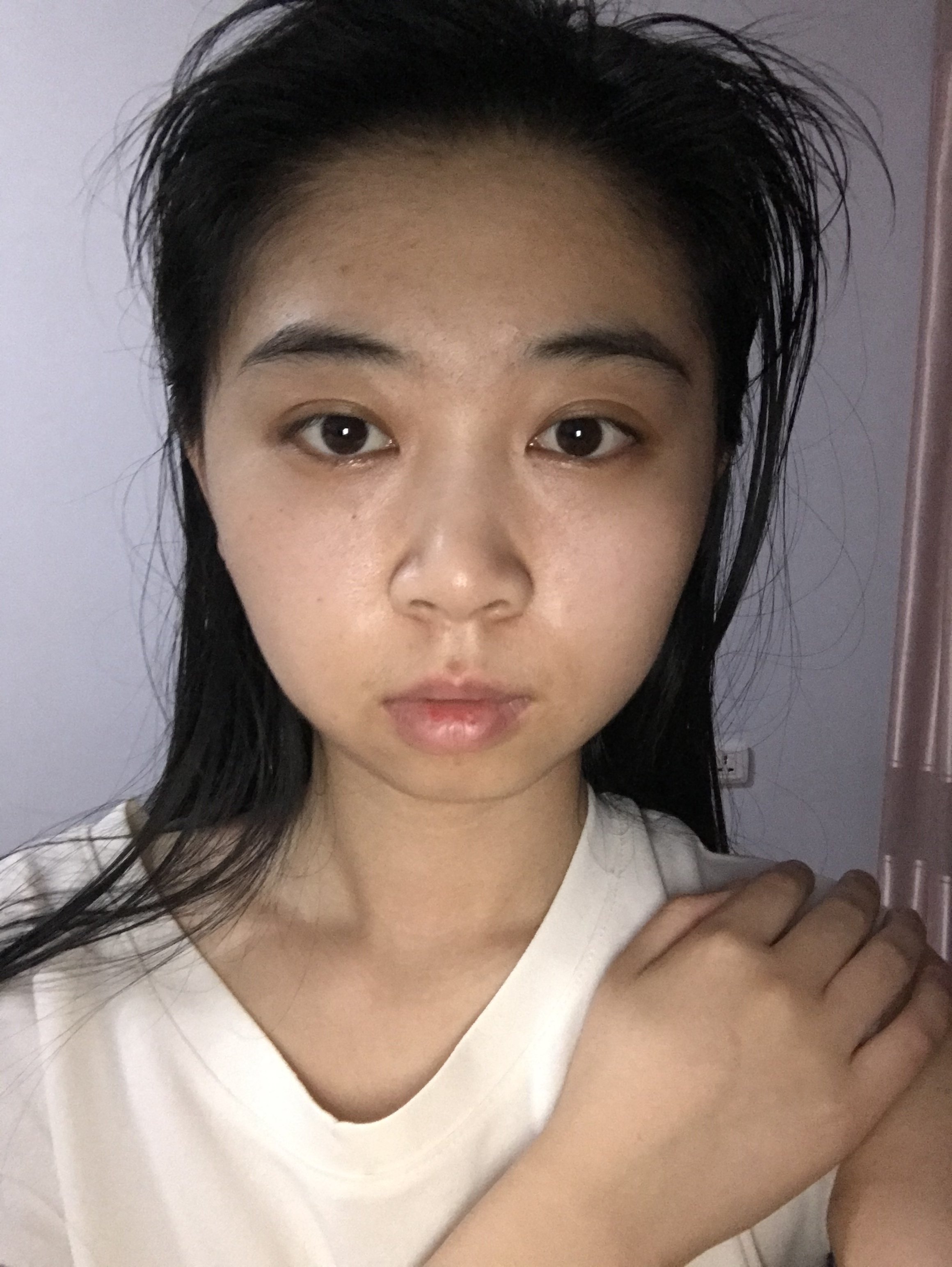 脸不对称一大一小怎么办